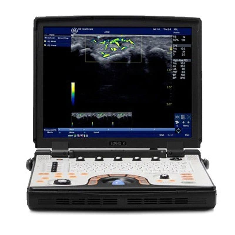 GE NextGen LOGIQ e R8 ultrasound system